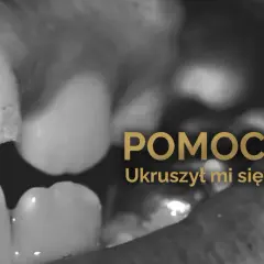 Zbliżenie na ukruszony ząb w jamie ustnej. Napis "POMOCY! Ukruszył mi się ząb" sugeruje pilną potrzebę interwencji dentystycznej.