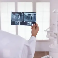 Dentysta analizuje RTG zęba, sprawdzając, ile kanałów ma 5.