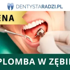 Dentysta zakłada plombę w zębie. Na ekranie widnieje napis "CENA" i "PLOMBA W ZĘBIE".