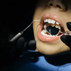 Dziecko u dentysty, badanie jamy ustnej lusterkiem. Czas, kiedy wypadają zęby mleczne, to ważny etap rozwoju.