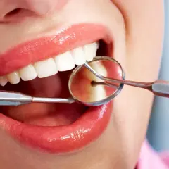 Uśmiech z błyszczącymi ustami i białymi zębami, badany lusterkiem dentystycznym. Czy bonding jest odwracalny?