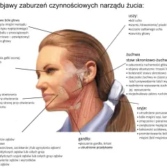 Ból żuchwy, głowy, uszu, oczu, gardła, szyi, zębów i jamy ustnej. Ilustracja przedstawia objawy zaburzeń narządu żucia.