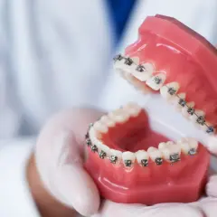 Dłonie w rękawiczkach trzymają model szczęki z aparatem ortodontycznym. To praca technika dentystycznego.