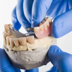 Dentyści prezentują protezę szkieletową na zatrzaskach, dopasowując ją do modelu szczęki.