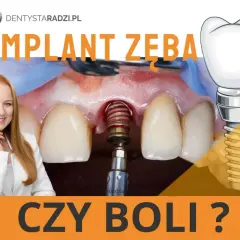 Implant zęba czy boli? Uśmiechnięta dentystka i zbliżenie na implant w trakcie zabiegu.
