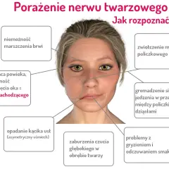 Ból twarzy i dziąseł po przewianiu? Poznaj objawy i skuteczne leczenie