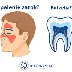 Zapalenie zatok czy tragiczny ból zęba? Ilustracja porównuje objawy zapalenia zatok z przekrojem zęba, sugerując, że oba mogą być przyczyną bólu.