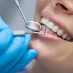 Co robi dentysta? Odkryj, jak dba o Twój uśmiech!