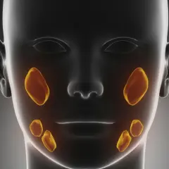 Anatomical rendering of a human head showing salivary glands highlighted in yellow. This visualization helps understand the location of potential kamica ślinianek.