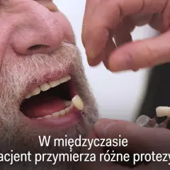 Czy dziąsła odrastają? Ekspert obala mity. Leczenie i profilaktyka