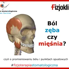Model czaszki z zaznaczonym mięśniem skroniowym, ilustrujący ból szczęki w zawiasach. Czy to ból zęba czy mięśnia?
