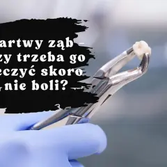 Nagły ból zęba w sobotę? Znajdź dentystę i ulgę krok po kroku