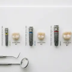 Różne implanty zębowe i korony, pokazujące elementy wpływające na koszt implantu zęba.