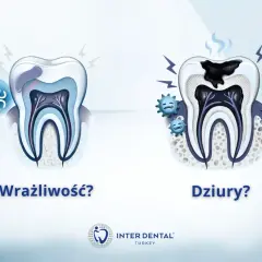 Wrażliwy ząb reaguje na zimno, a próchnica powoduje ból zęba przy nagryzaniu.