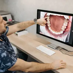 Dentysta pokazuje pacjentowi na ekranie powiększony obraz jamy ustnej, wskazując na zdrową kieszonkę dziąsłową.