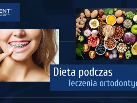 Dieta z aparatem ortodontycznym: Co jeść, by uniknąć bólu i awarii?