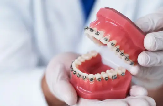 Dłonie w rękawiczkach trzymają model szczęki z aparatem ortodontycznym. To praca technika dentystycznego.