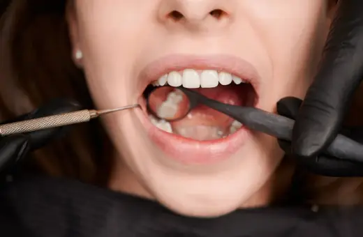 Ząb po leczeniu kanałowym boli przy nacisku. Dentysta bada jamę ustną pacjentki lusterkiem i narzędziem.
