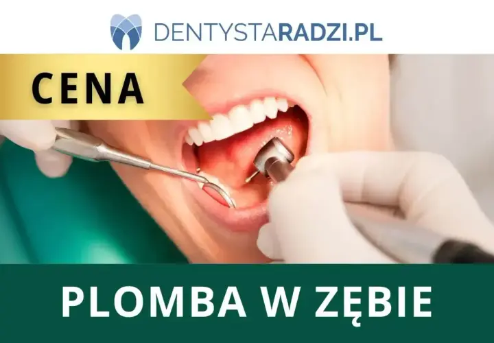 Cena plomby u dentysty? Zobacz, ile kosztuje leczenie zęba i jakie są dostępne opcje.