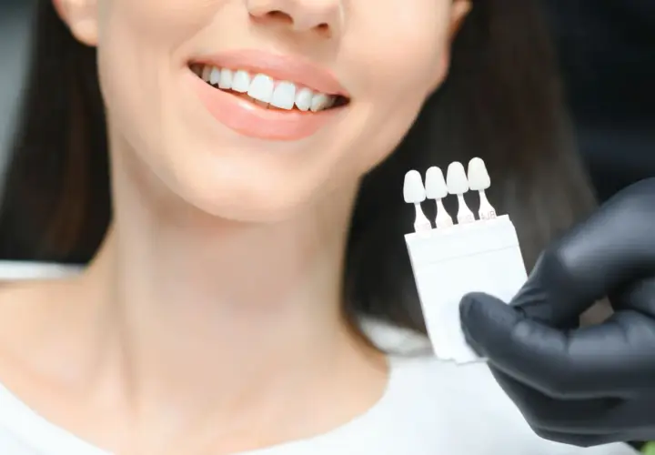Uśmiechnięta kobieta z białymi zębami, dentysta porównuje odcień zębów z wzornikiem przed wybielaniem.