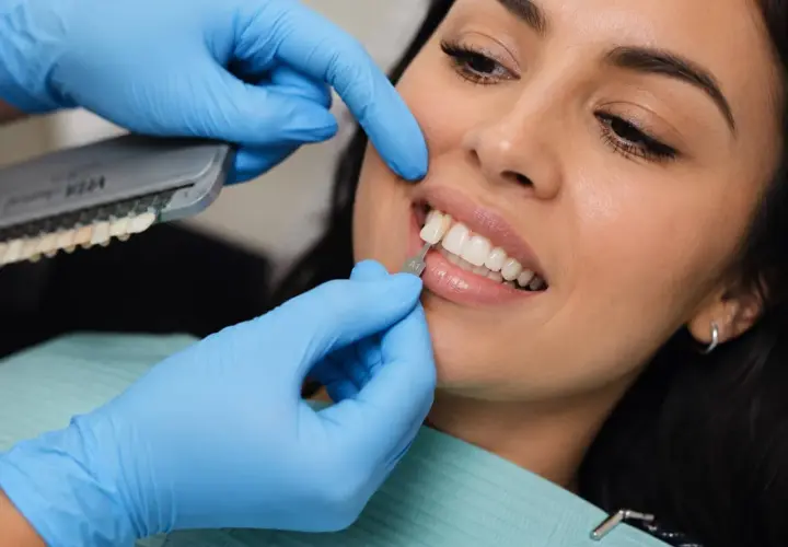 Dobór idealnego odcienia licówek kompozytowych. Dentysta porównuje kolor zębów pacjentki z wzornikiem.