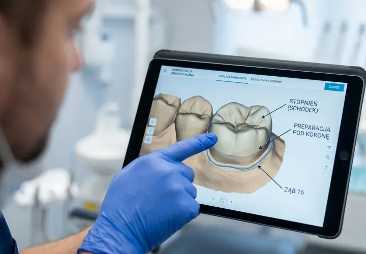 Dentysta w niebieskiej rękawiczce pokazuje na tablecie spiłowane zęby pod korony, analizując preparację.