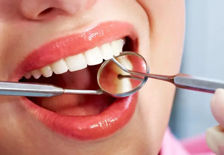Uśmiech z błyszczącymi ustami i białymi zębami, badany lusterkiem dentystycznym. Czy bonding jest odwracalny?