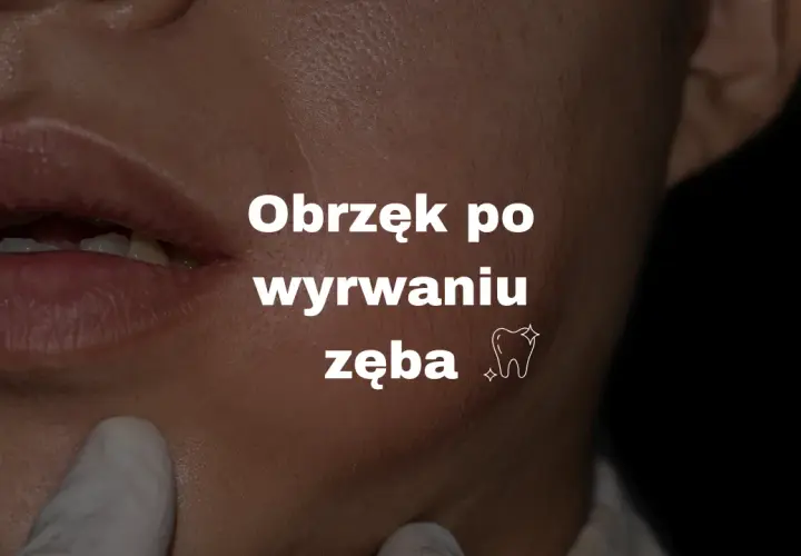 Szybkie gojenie po ekstrakcji zęba: uniknij bólu i powikłań!