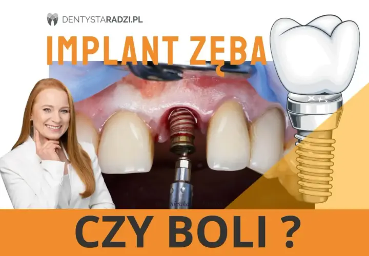 Implant zęba czy boli? Uśmiechnięta dentystka i zbliżenie na implant w trakcie zabiegu.