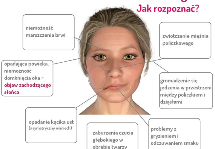 Ból twarzy i dziąseł po przewianiu? Poznaj objawy i skuteczne leczenie