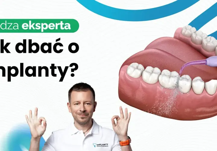 Ulga od bólu dziąseł pod protezą: Co działa naprawdę?
