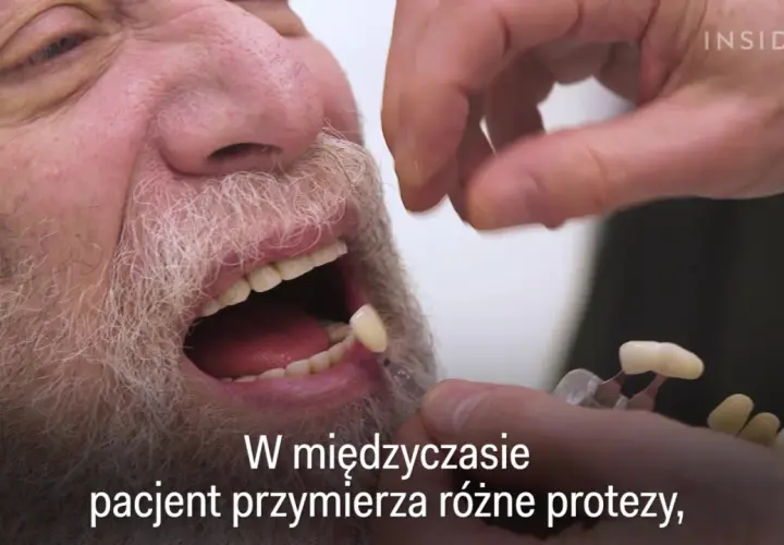 Czy dziąsła odrastają? Ekspert obala mity. Leczenie i profilaktyka