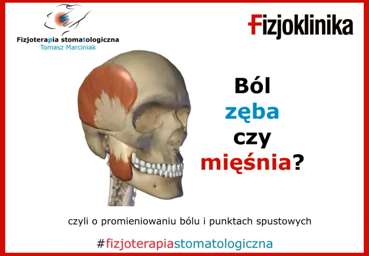 Model czaszki z zaznaczonym mięśniem skroniowym, ilustrujący ból szczęki w zawiasach. Czy to ból zęba czy mięśnia?