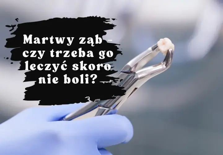 Nagły ból zęba w sobotę? Znajdź dentystę i ulgę krok po kroku