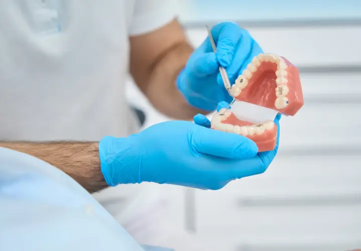 Dentysta w niebieskich rękawiczkach pokazuje model szczęki z protezą teleskopową, wyjaśniając jej działanie.