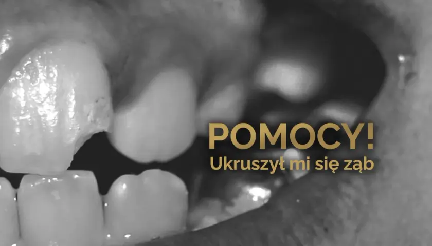 Zbliżenie na ukruszony ząb w jamie ustnej. Napis "POMOCY! Ukruszył mi się ząb" sugeruje pilną potrzebę interwencji dentystycznej.