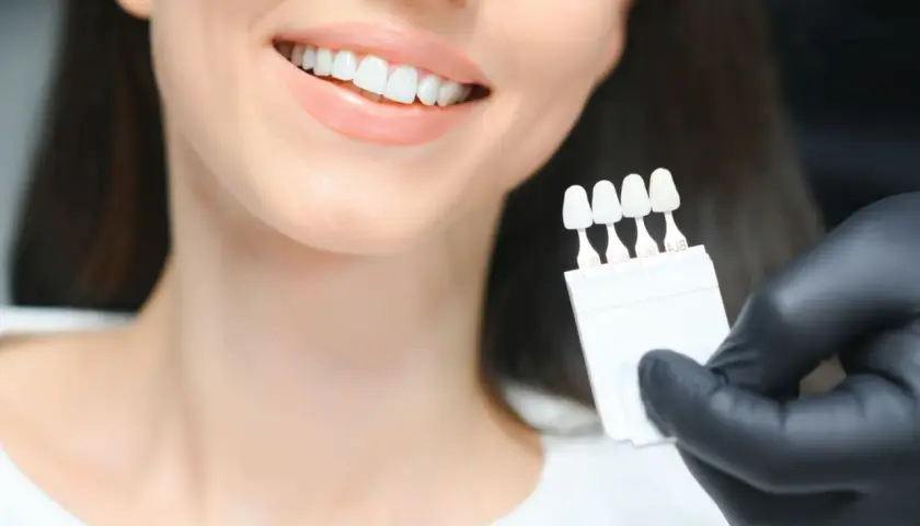 Uśmiechnięta kobieta z białymi zębami, dentysta porównuje odcień zębów z wzornikiem przed wybielaniem.