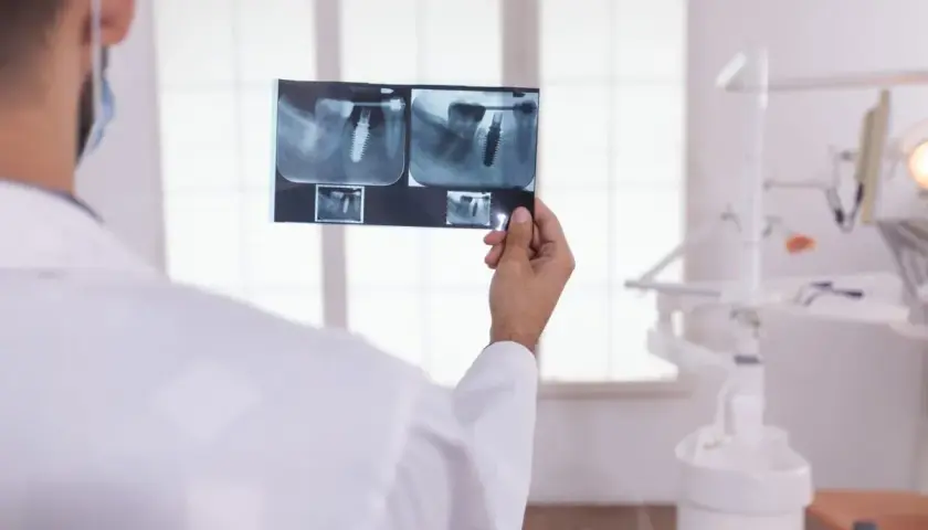 Dentysta analizuje RTG zęba, sprawdzając, ile kanałów ma 5.
