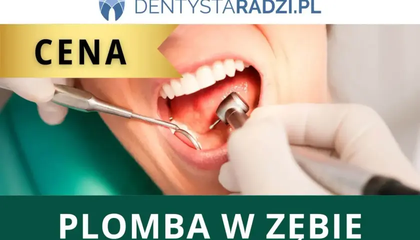 Dentysta zakłada plombę w zębie. Na ekranie widnieje napis "CENA" i "PLOMBA W ZĘBIE".