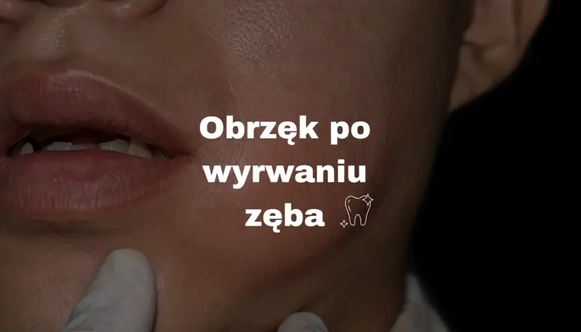 Szybkie gojenie po ekstrakcji zęba: uniknij bólu i powikłań!