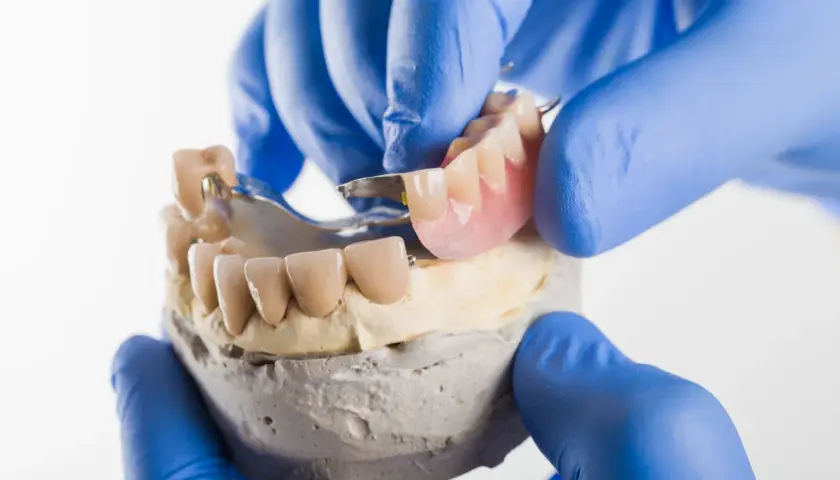 Dentyści prezentują protezę szkieletową na zatrzaskach, dopasowując ją do modelu szczęki.