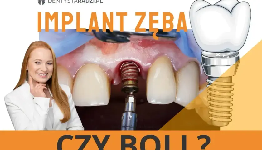 Implant zęba czy boli? Uśmiechnięta dentystka i zbliżenie na implant w trakcie zabiegu.