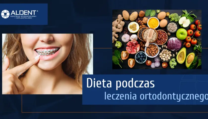 Dieta z aparatem ortodontycznym: Co jeść, by uniknąć bólu i awarii?