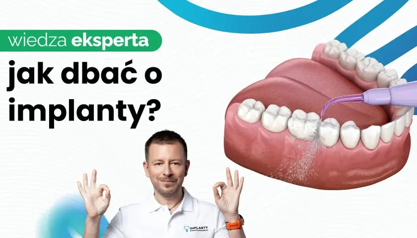 Ulga od bólu dziąseł pod protezą: Co działa naprawdę?