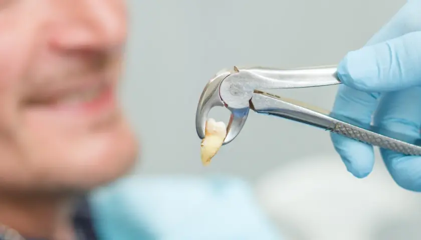 Chwila po wyrwaniu zęba, gdy dentysta trzyma go w kleszczach. Pacjent w tle uśmiecha się z ulgą.