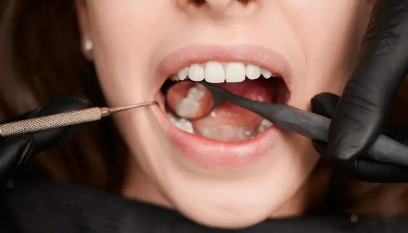 Usta kobiety otwarte, dentysta w czarnej rękawiczce używa lusterka i narzędzia do badania zębów. To nie jest wyrywanie 8, ale kontrola.