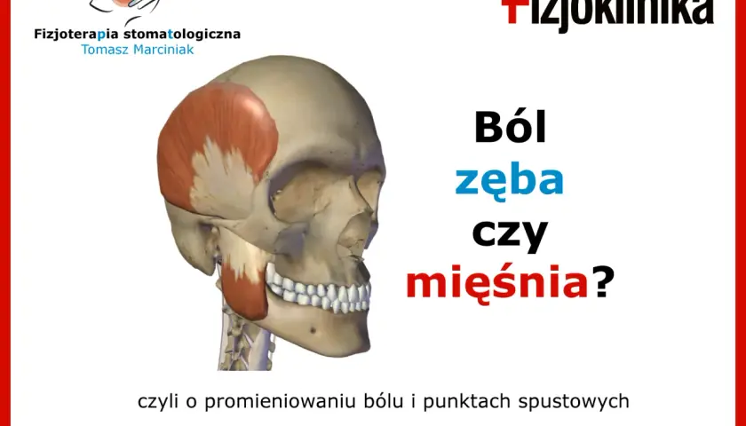 Model czaszki z zaznaczonym mięśniem skroniowym, ilustrujący ból szczęki w zawiasach. Czy to ból zęba czy mięśnia?