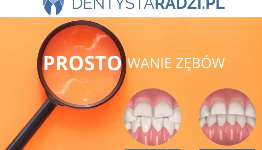 Przed i po: proste zęby dzięki licówkom. Zobacz, jak licówki na krzywe zęby zmieniają uśmiech.