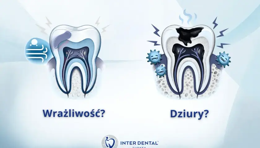 Wrażliwy ząb reaguje na zimno, a próchnica powoduje ból zęba przy nagryzaniu.