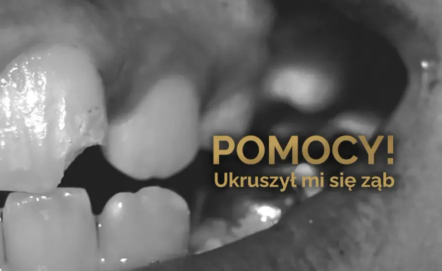 Ukruszony ząb - Jak naprawić i ile to kosztuje?